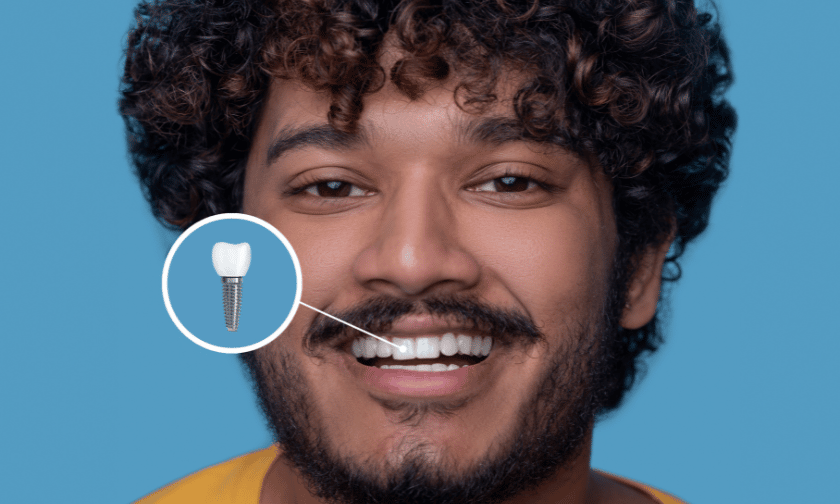 All-on-4 Treatment Brookings