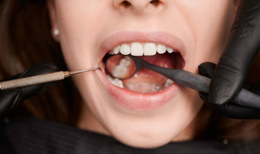 Dental Fillings in Brookings, OR