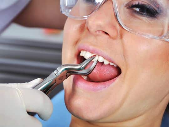 Tooth Extractions in Brookings -Brookings Dental Arts